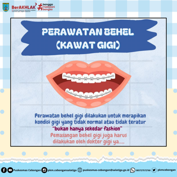 Perawatan Behel (Kawat Gigi)